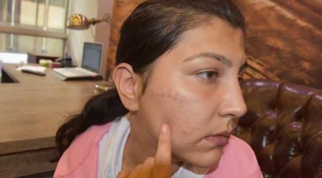 Bıçaklanan kadının avukatı 'reddi heyet' talep etti