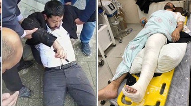 Hakkari'de terör elebaşı Öcalan'a özgürlük yürüyüşünde ayağı kırıldı!