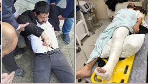 Hakkari'de terör elebaşı Öcalan'a özgürlük yürüyüşünde ayağı kırıldı!