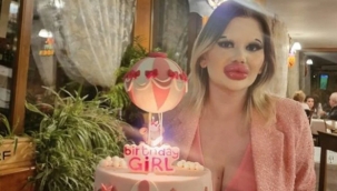 Dünyanın en büyük dudaklı kadını