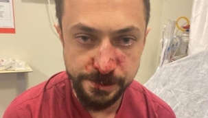 Hasta yakını, acil serviste doktorun burnunu kırdı