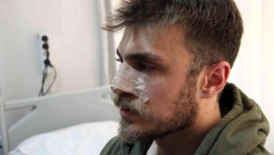 İzmir'de doktora saldırı! Burnunu kırdı