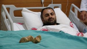 Mesanesinden 550 gram ağırlığında 20 taş çıktı