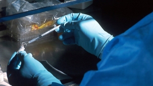 Türkiye'de 26 bini erkek olmak üzere toplam 32 bin 376 kişi AİDS hastası