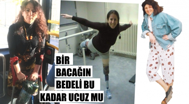 Bacağı kazada kopan yolcunun davası 20 yılda bitti