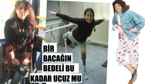 Bacağı kazada kopan yolcunun davası 20 yılda bitti