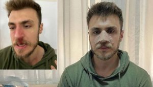 Dövülen doktor kafa travması geçirmiş