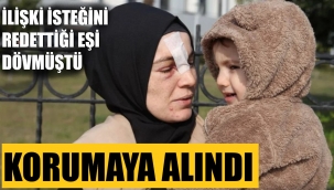 İlişki talebini reddettiği kocası dövmüştü! Korumaya alındı