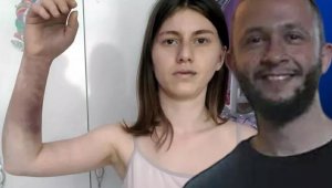 Kız arkadaşını beyzbol sopasıyla dövmüştü! İşte cezası