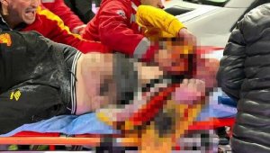 Yüzümdeki acıyla kendimi kaybettim!