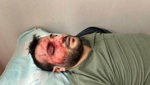 Ameliyathanede kavga! Doktorlar birbirine girdi