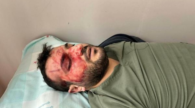 Ameliyathanede kavga! Doktorlar birbirine girdi