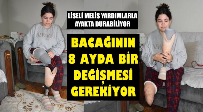 Liseli Melis'e 8 ayda bir bacak takılıyor