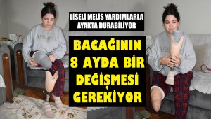 Liseli Melis'e 8 ayda bir bacak takılıyor