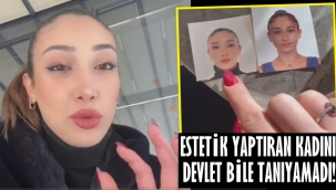 Estetik yaptırdı, yeni fotoğrafını nüfus kabul etmedi