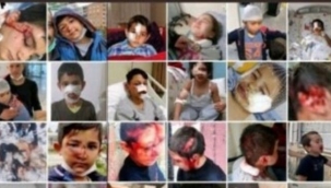 Bu çocuklara iyi bakın! Sokak köpeği mağdurları