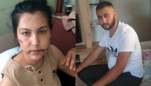 Canavarca hisle yaralamadan dava açıldı