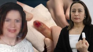 Eski eşinin sevgilisinin parmağını ısırdı