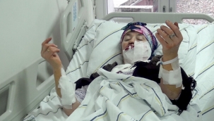 Kuduz olan kurt köye saldırdı, 4 kişiyi yaraladı!