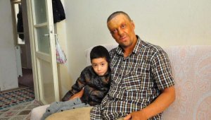 Bu halimle dışlanıyorum, çocuklar bile korkuyor