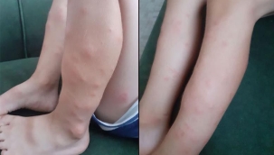  Foça'yı sivrisinekler istila etti