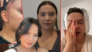 Yüzünü gerdirirken hayatı karardı