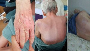 Huzurevinde ölüm! Banyoda haşlamışlar