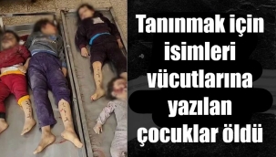 İsimleri vücutlarına yazılan çocukları öldürdüler