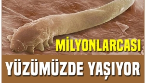 Öpüşürken bir daha düşünün! Bu canlılar yüzümüzde yaşıyor