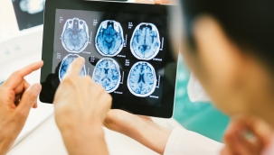 Yapay zeka ile 1 saniyede kanser teşhisi