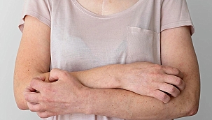 Uyuz hastalığı! 30 kat hızla yayılıyor