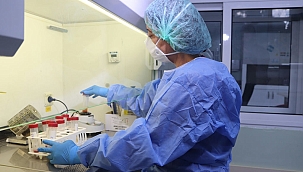 Prof. Dr. Karadeniz: "Dünya nüfusunun üçte biri tüberküloz mikrobuyla enfekte oldu"