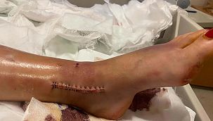 İzmir'de eski eşi ile oğlunu yaraladı