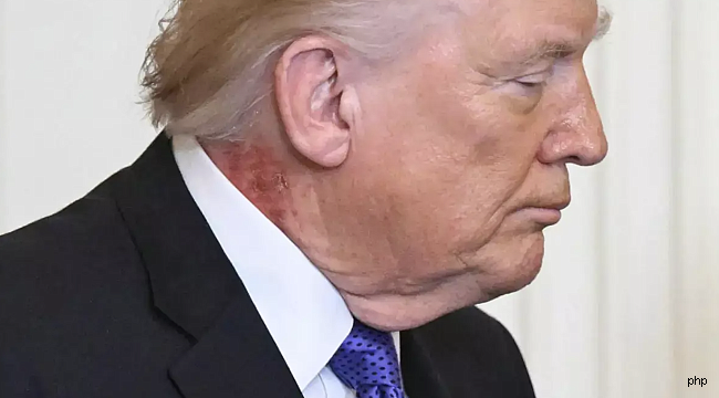 Beyaz Saray'dan sağlık tartışmalarına açıklama