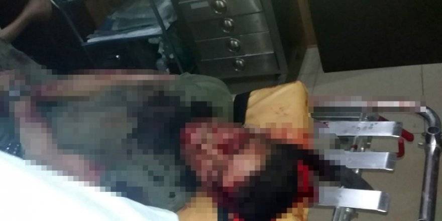 Afrin’de bombalı saldırıda ölü ve yaralılar var