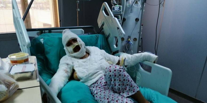 Cezaevinden izinli çıktı: Birlikte yaşadığı kadını önce bıçakladı, sonra kızgın yağla yaktı!