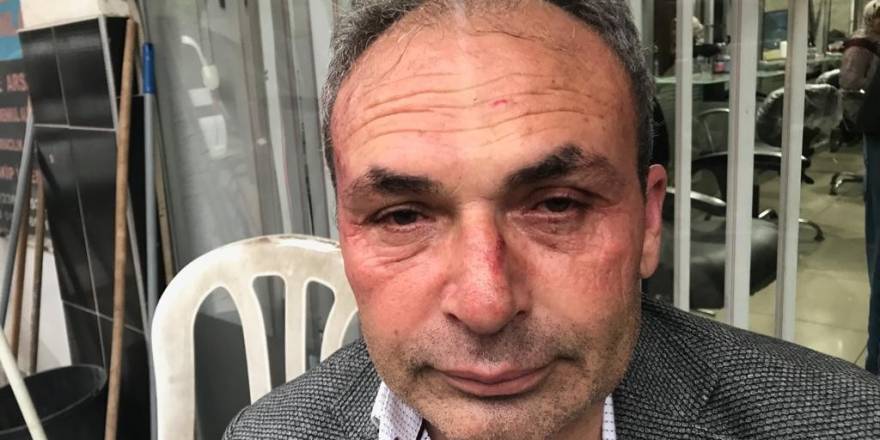 CHP’li Belediye Başkan Yardımcısına saldırı anı güvenlik kamerasında